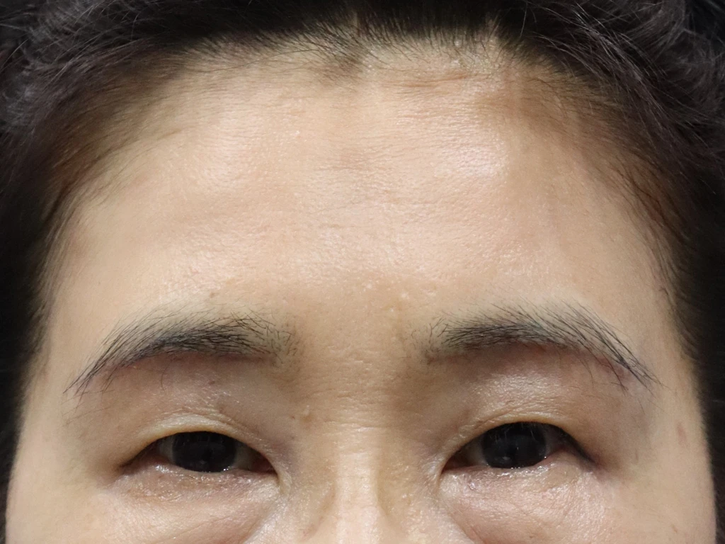 before_image