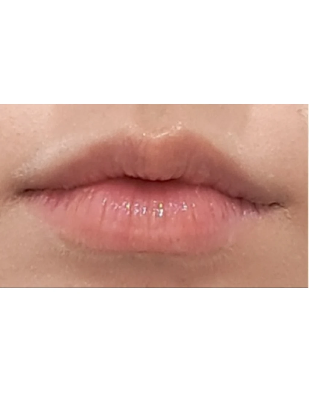before_image