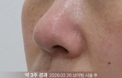 before_image