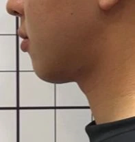 before_image