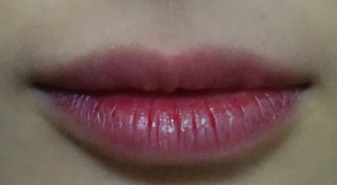 before_image
