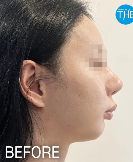before_image