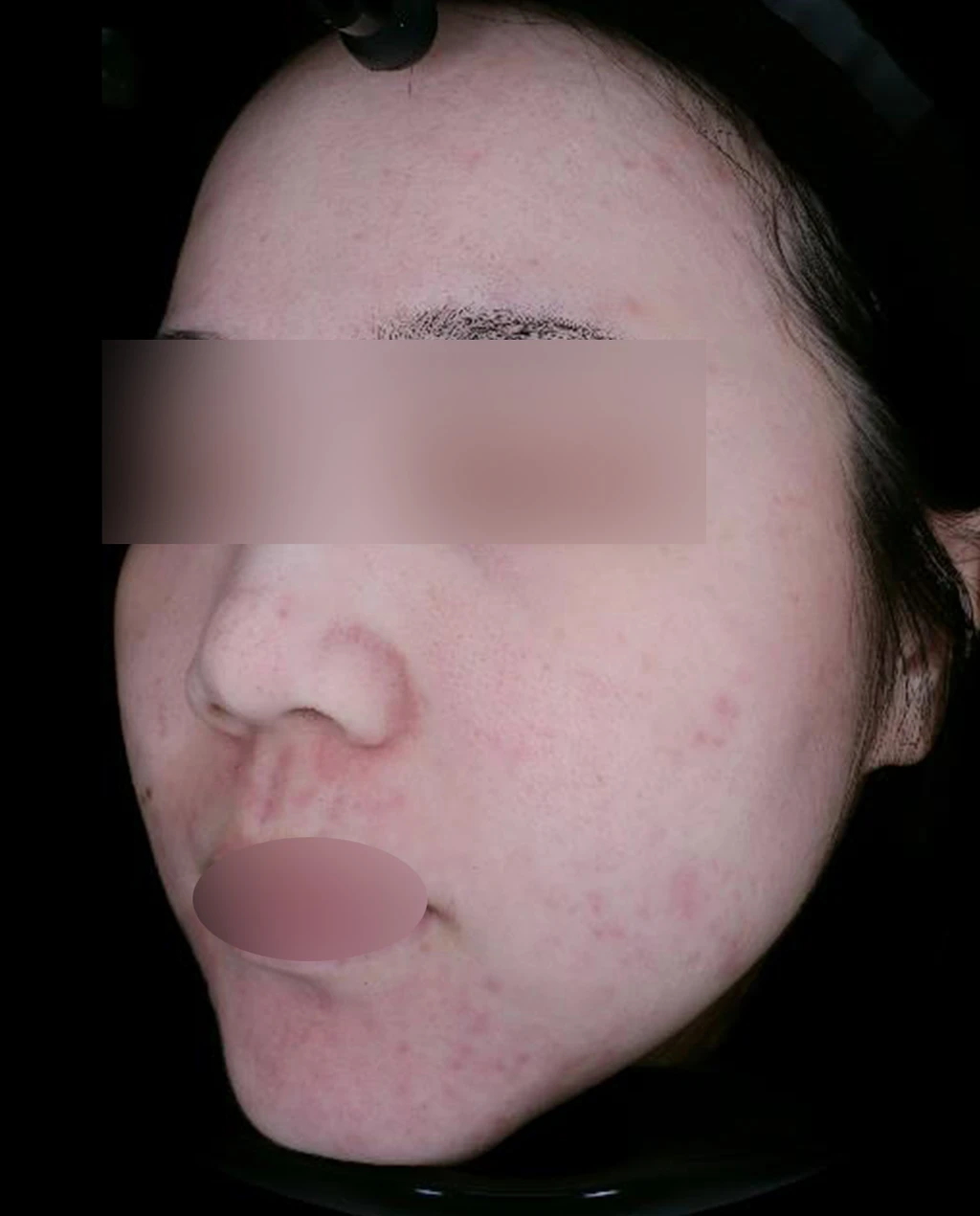 before_image