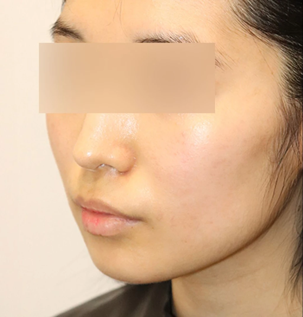 before_image