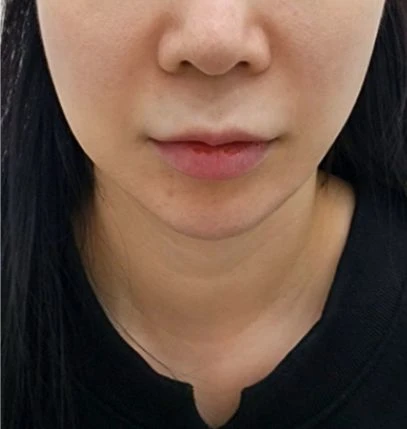 before_image