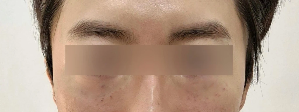 before_image