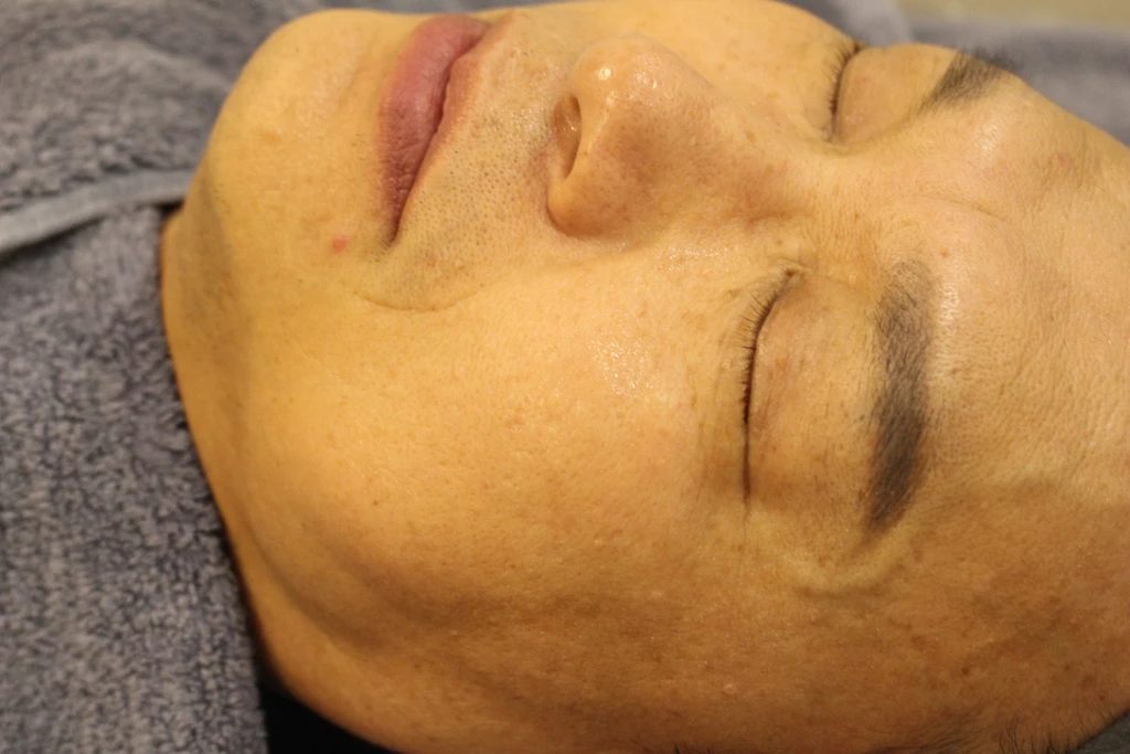 before_image