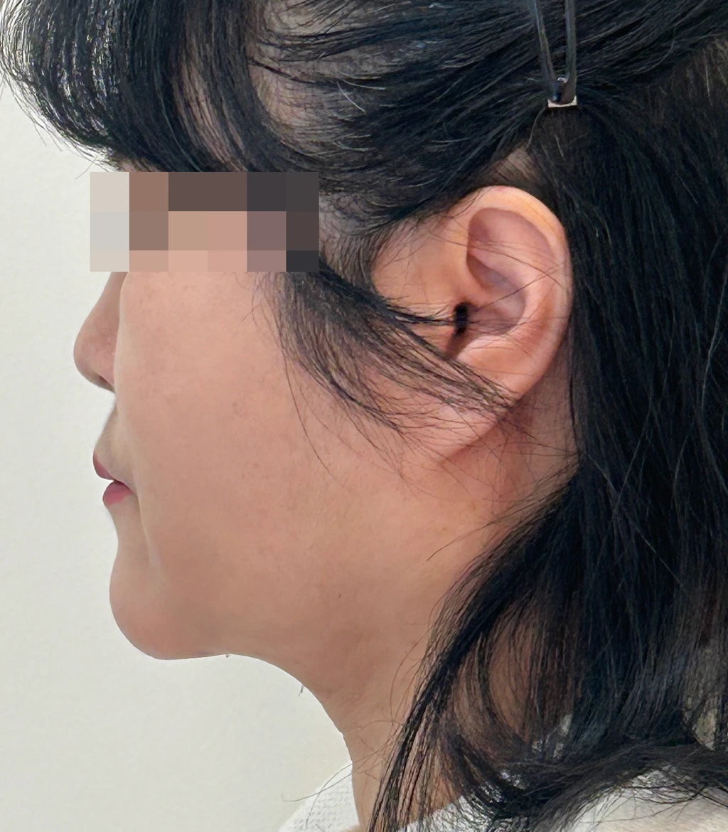 before_image