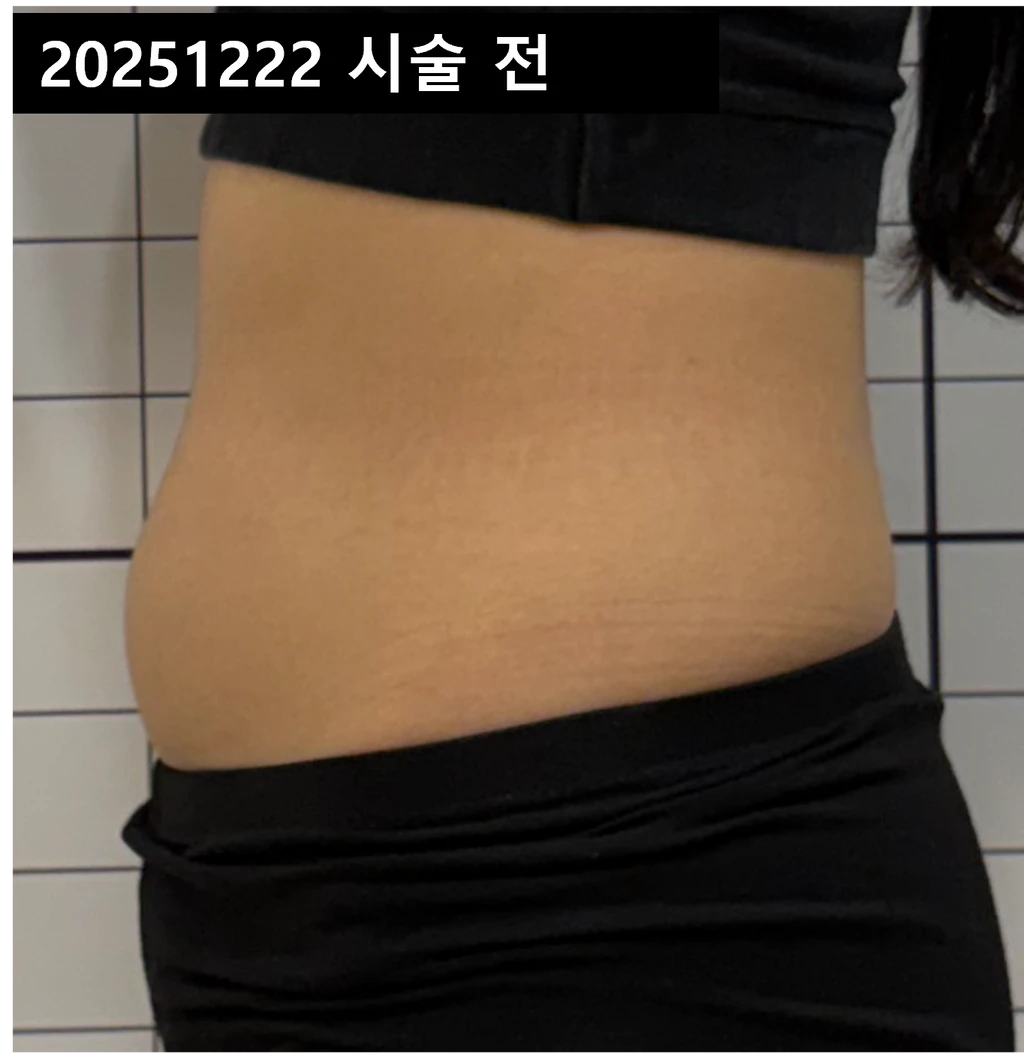 before_image