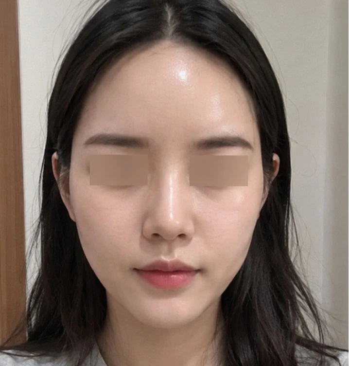 before_image