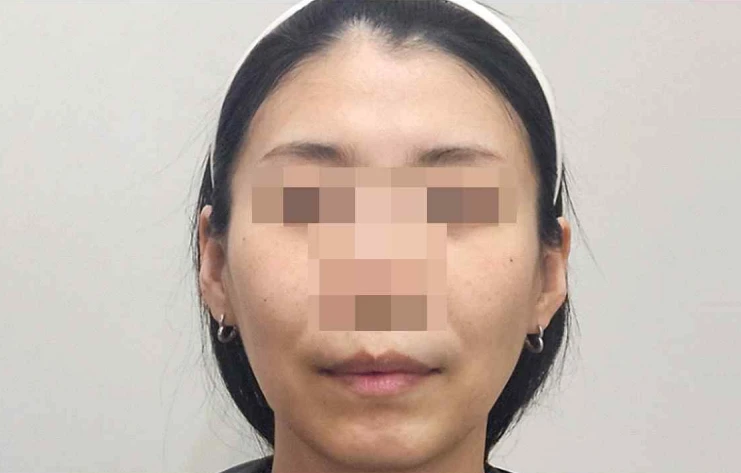 before_image