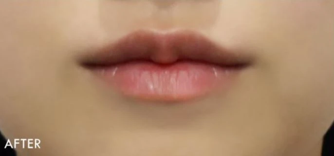 before_image