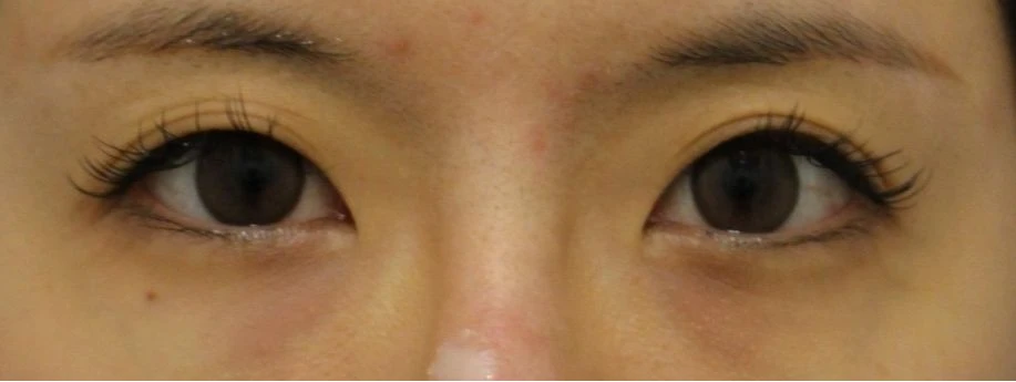 before_image