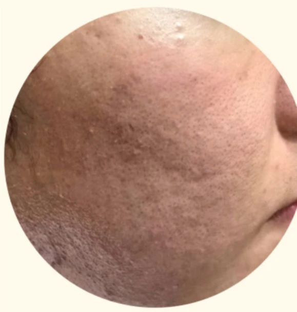 before_image