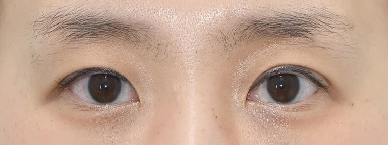 before_image