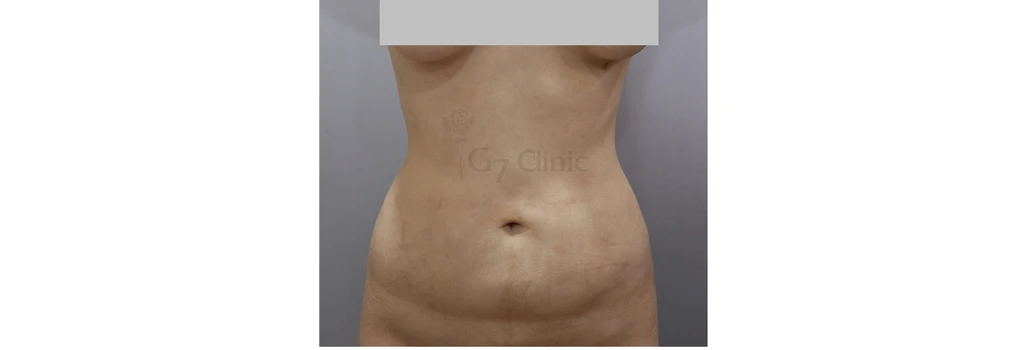 before_image