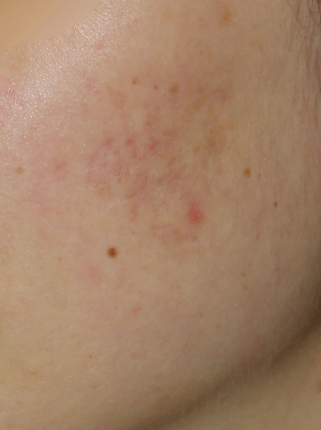 before_image