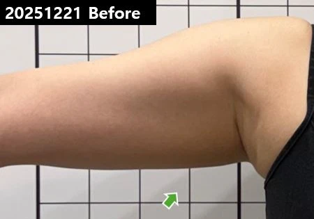 before_image