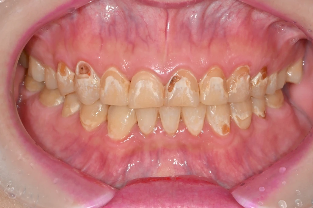 before_image