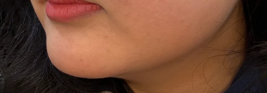 before_image