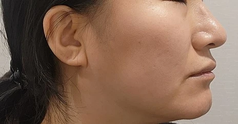 before_image