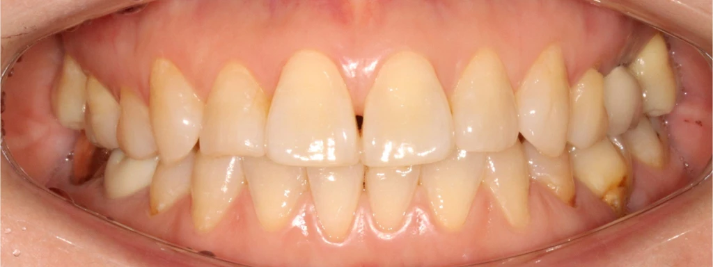 before_image