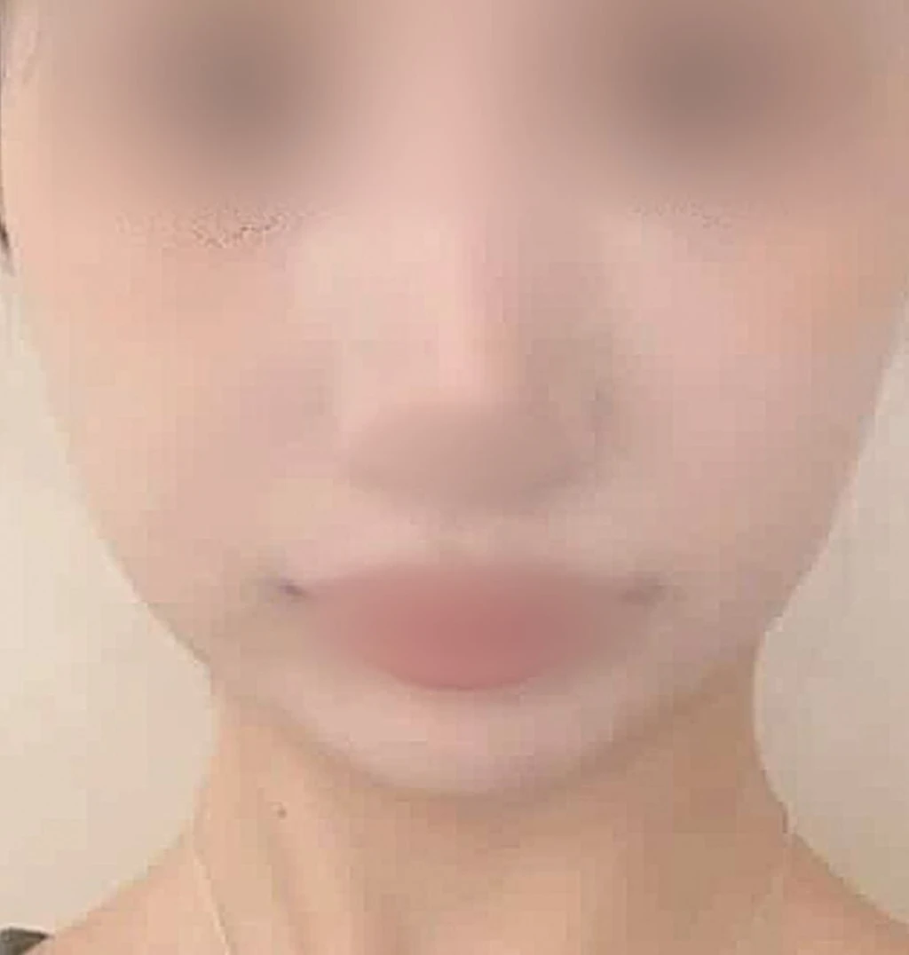 before_image