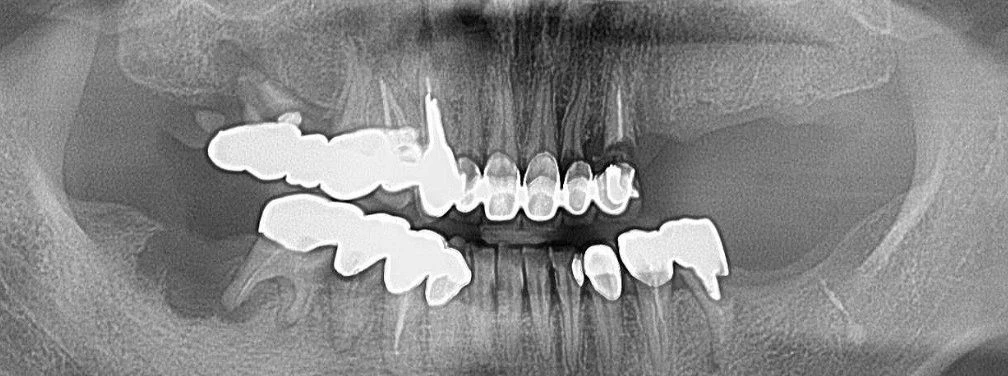 before_image