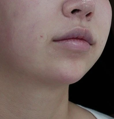 before_image
