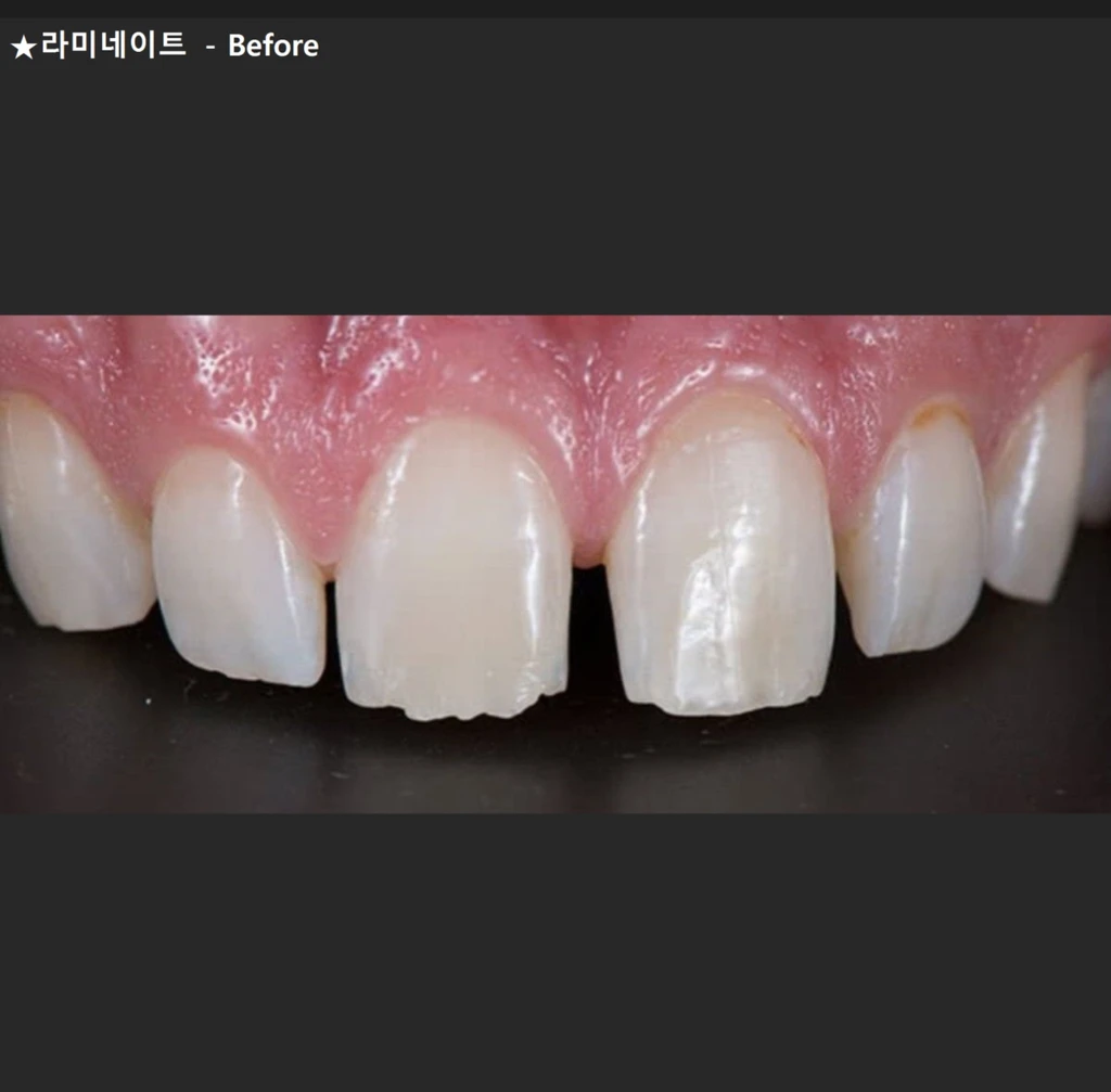before_image