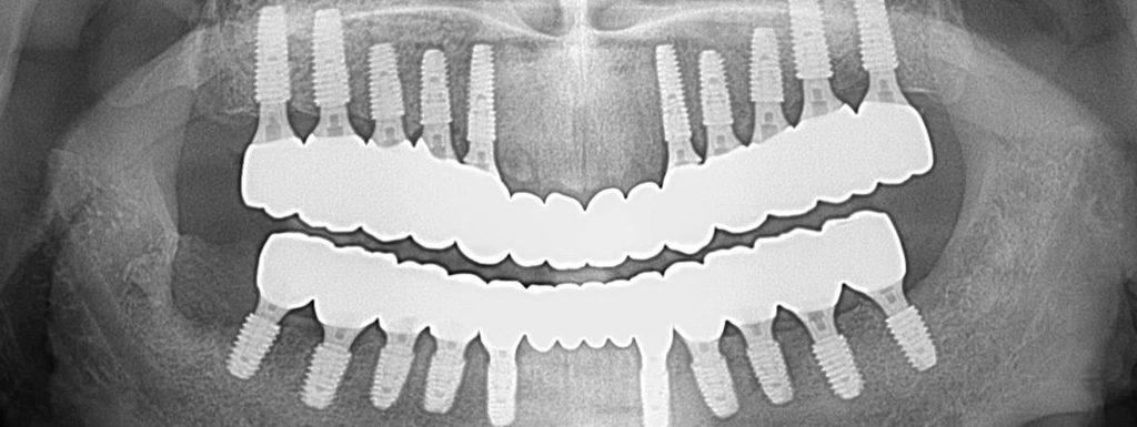 before_image