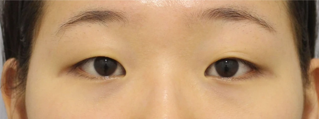 before_image