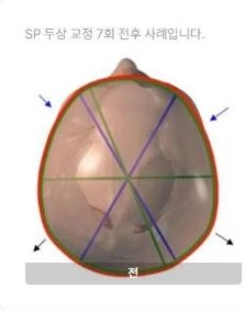 before_image