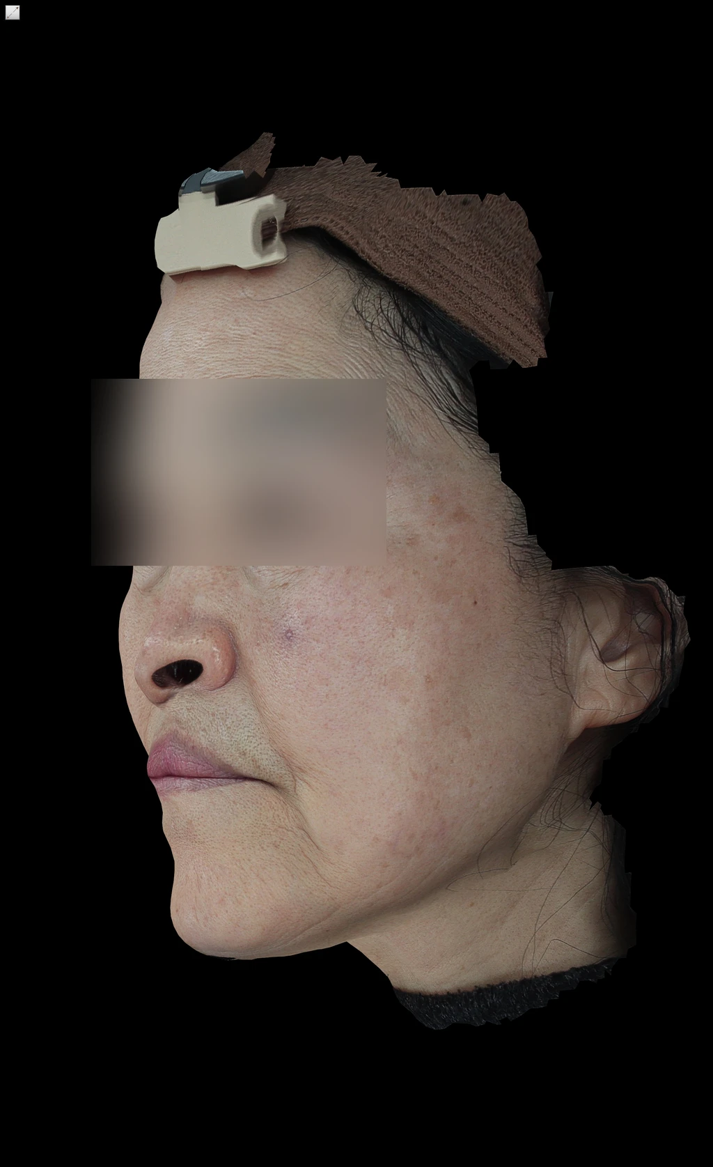 before_image