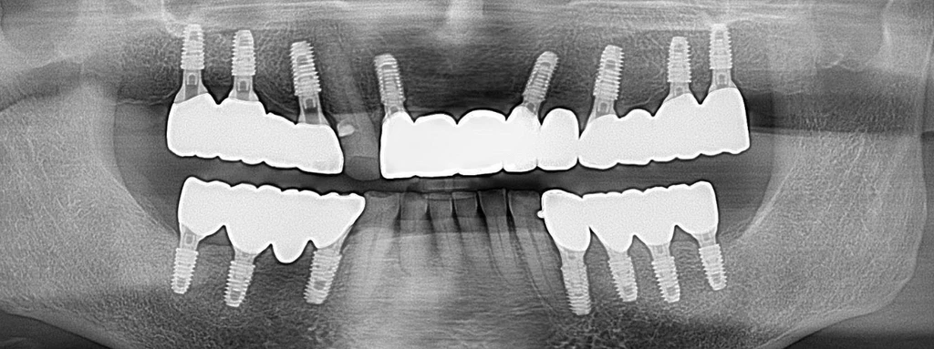 before_image
