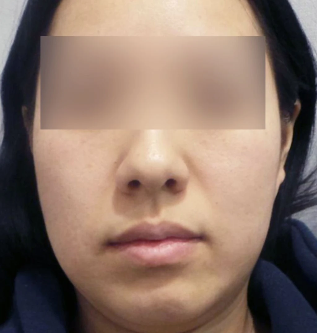 before_image