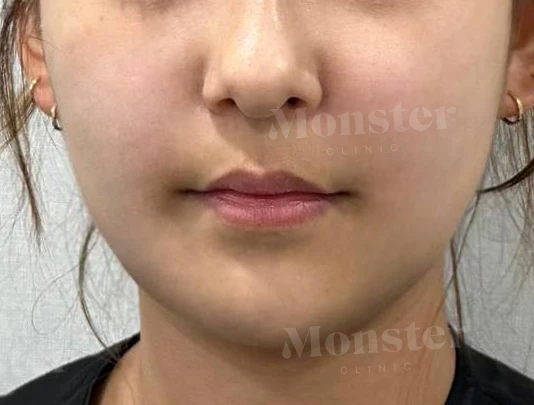 before_image