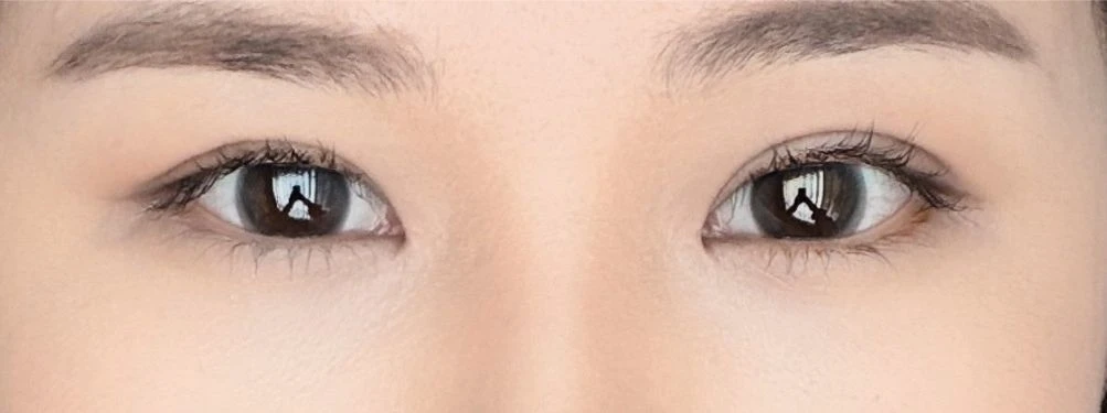 before_image