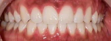 before_image