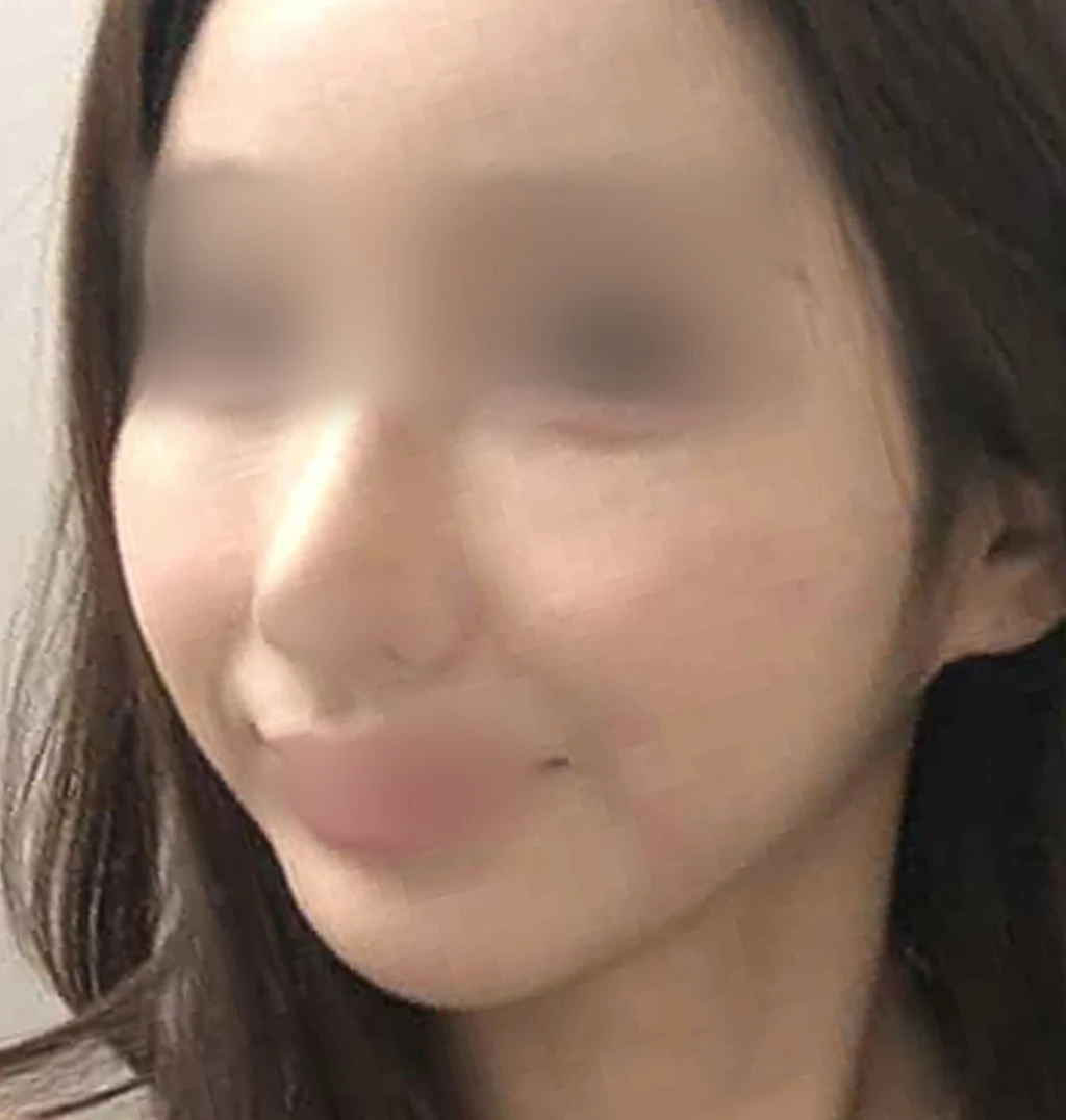 before_image