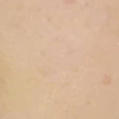 before_image