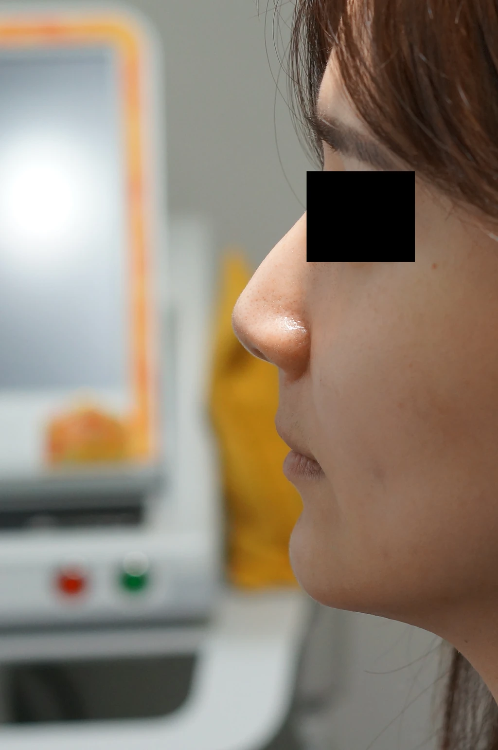 before_image