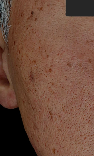 before_image