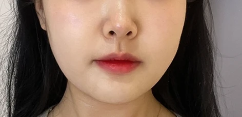 before_image