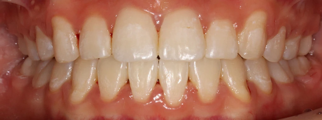 before_image