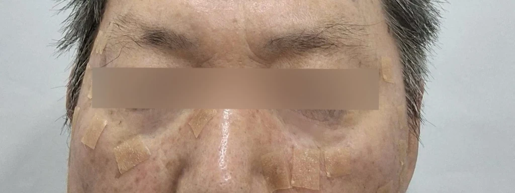 before_image