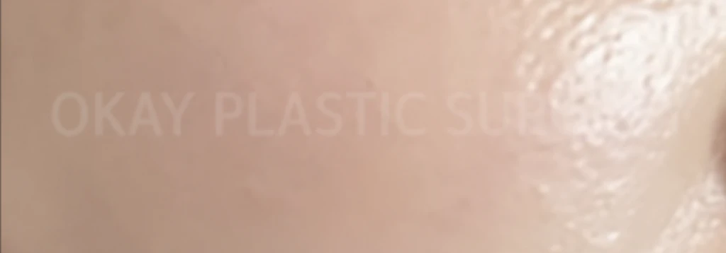 before_image