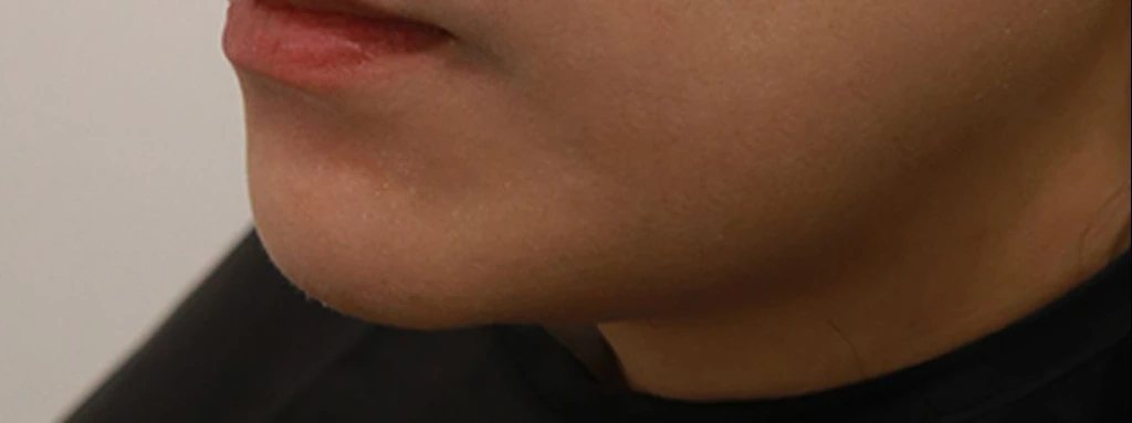 before_image