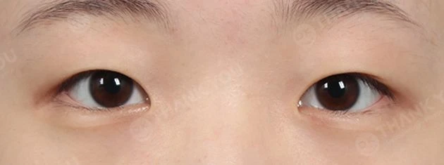 before_image