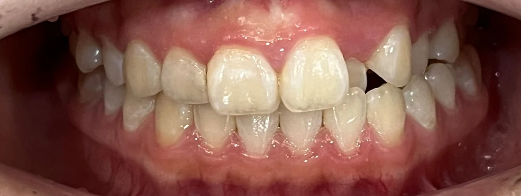 before_image
